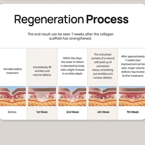 Elaxen PLLA Skincare Mask Set. - Picture 6 of 7